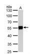 Calcium/Calmodulin Dependent Protein Kinase IG antibody, NBP1-31624, Novus Biologicals, Western Blot image 