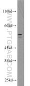 EGF-response factor 2 antibody, 12056-1-AP, Proteintech Group, Western Blot image 