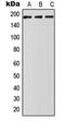 ATP Binding Cassette Subfamily A Member 5 antibody, orb215084, Biorbyt, Western Blot image 