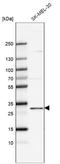 F-Box Protein 44 antibody, NBP1-84728, Novus Biologicals, Western Blot image 