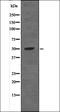 Protein Tyrosine Phosphatase Non-Receptor Type 1 antibody, orb335973, Biorbyt, Western Blot image 