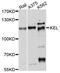 Kell Metallo-Endopeptidase (Kell Blood Group) antibody, abx136026, Abbexa, Western Blot image 