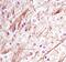 Neurofilament Light antibody, MA5-14981, Invitrogen Antibodies, Immunohistochemistry paraffin image 