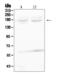 Ret Proto-Oncogene antibody, A00293-1, Boster Biological Technology, Western Blot image 