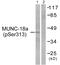 Syntaxin Binding Protein 1 antibody, PA5-38296, Invitrogen Antibodies, Western Blot image 