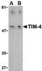 T Cell Immunoglobulin And Mucin Domain Containing 4 antibody, 3813, ProSci, Western Blot image 