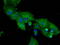 Dipeptidyl Peptidase 4 antibody, LS-B9993, Lifespan Biosciences, Immunofluorescence image 