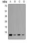 Frataxin antibody, LS-B14580, Lifespan Biosciences, Western Blot image 