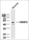 Poly(ADP-Ribose) Polymerase Family Member 3 antibody, orb101580, Biorbyt, Western Blot image 