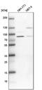 Poly(A)-Specific Ribonuclease antibody, NBP1-84303, Novus Biologicals, Western Blot image 