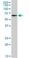 Catalase antibody, LS-C196823, Lifespan Biosciences, Western Blot image 