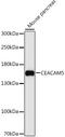 Carcinoembryonic Antigen Related Cell Adhesion Molecule 5 antibody, LS-C747524, Lifespan Biosciences, Western Blot image 