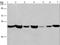 Adipocyte Plasma Membrane Associated Protein antibody, LS-C405879, Lifespan Biosciences, Western Blot image 