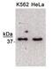 Nth Like DNA Glycosylase 1 antibody, PA1-16506, Invitrogen Antibodies, Western Blot image 