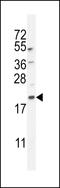 Microtubule Associated Protein 1 Light Chain 3 Beta antibody, LS-B9581, Lifespan Biosciences, Western Blot image 