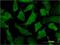 Proliferation-Associated 2G4 antibody, H00005036-M01, Novus Biologicals, Immunofluorescence image 