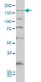 Synaptojanin 1 antibody, H00008867-M01, Novus Biologicals, Western Blot image 