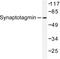 Synaptotagmin 1 antibody, LS-C176229, Lifespan Biosciences, Western Blot image 