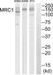 Mannose Receptor C-Type 1 antibody, abx014566, Abbexa, Western Blot image 