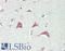 Myosin VIIA antibody, LS-B13642, Lifespan Biosciences, Immunohistochemistry paraffin image 