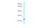 Rho Family GTPase 1 antibody, ARP61632_P050, Aviva Systems Biology, Western Blot image 