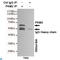 Pyruvate Kinase M1/2 antibody, LS-C813084, Lifespan Biosciences, Immunoprecipitation image 