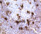 MER Proto-Oncogene, Tyrosine Kinase antibody, 13-990, ProSci, Immunohistochemistry frozen image 