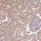 TRNA Splicing Endonuclease Subunit 54 antibody, NBP2-30377, Novus Biologicals, Immunohistochemistry paraffin image 