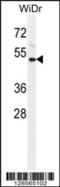 Interleukin 1 Receptor Type 2 antibody, 55-587, ProSci, Western Blot image 