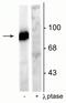 Dynamin 1 antibody, P02536-1, Boster Biological Technology, Western Blot image 