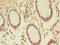Transmembrane P24 Trafficking Protein 3 antibody, CSB-PA897107LA01HU, Cusabio, Immunohistochemistry paraffin image 