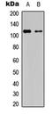 Protein Kinase D1 antibody, LS-C358793, Lifespan Biosciences, Western Blot image 