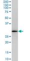 Regulator Of G Protein Signaling 20 antibody, H00008601-M04, Novus Biologicals, Western Blot image 