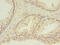 HD Domain Containing 3 antibody, CSB-PA836666HA01HU, Cusabio, Immunohistochemistry frozen image 