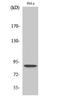 Signal Transducer And Activator Of Transcription 5A antibody, STJ90773, St John