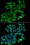 PHD Finger Protein 11 antibody, GTX65536, GeneTex, Immunofluorescence image 