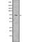 DEAD-Box Helicase 3 X-Linked antibody, abx149761, Abbexa, Western Blot image 