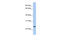 Calcium release-activated calcium channel protein 1 antibody, 30-572, ProSci, Western Blot image 