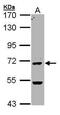 Peptidyl Arginine Deiminase 4 antibody, PA5-34702, Invitrogen Antibodies, Western Blot image 