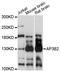 Adaptor Related Protein Complex 3 Subunit Beta 2 antibody, LS-C748831, Lifespan Biosciences, Western Blot image 