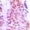 60S ribosomal protein L28 antibody, orb214529, Biorbyt, Immunohistochemistry paraffin image 