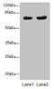 Phosphoglucomutase 2 Like 1 antibody, CSB-PA764776LA01HU, Cusabio, Western Blot image 