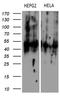 Keratin 16 antibody, LS-C794362, Lifespan Biosciences, Western Blot image 