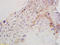 Cytochrome P450 Family 19 Subfamily A Member 1 antibody, 251655, Abbiotec, Immunohistochemistry paraffin image 