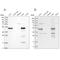 3-Hydroxy-3-Methylglutaryl-CoA Synthase 2 antibody, PA5-55620, Invitrogen Antibodies, Western Blot image 