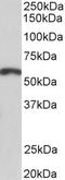 Paired Box 3 antibody, LS-C154962, Lifespan Biosciences, Western Blot image 