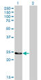 Glutathione S-Transferase Mu 4 antibody, LS-C197368, Lifespan Biosciences, Western Blot image 