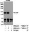 RB Binding Protein 8, Endonuclease antibody, NB100-79809, Novus Biologicals, Immunoprecipitation image 
