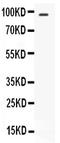 Signal Transducer And Activator Of Transcription 6 antibody, PB9405, Boster Biological Technology, Western Blot image 