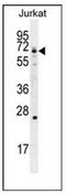 Glutamate-Cysteine Ligase Catalytic Subunit antibody, AP51800PU-N, Origene, Western Blot image 